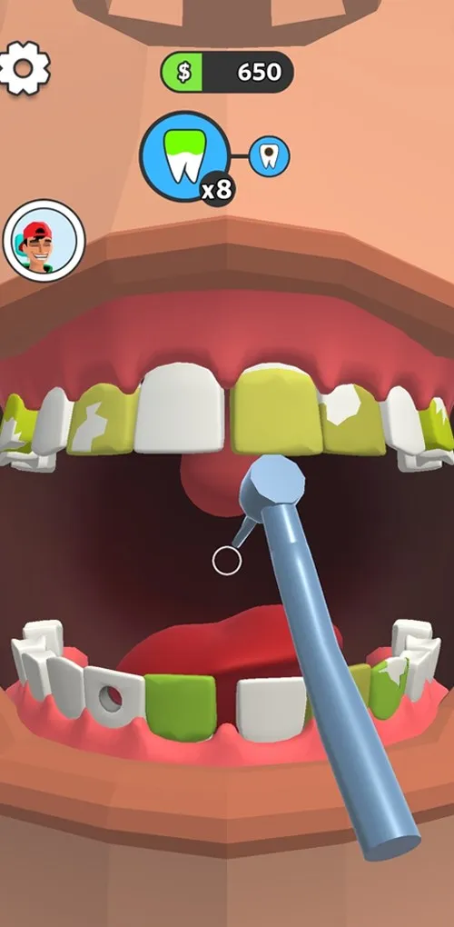 Loại bỏ các mảng bám và điều trị sâu răng trong game